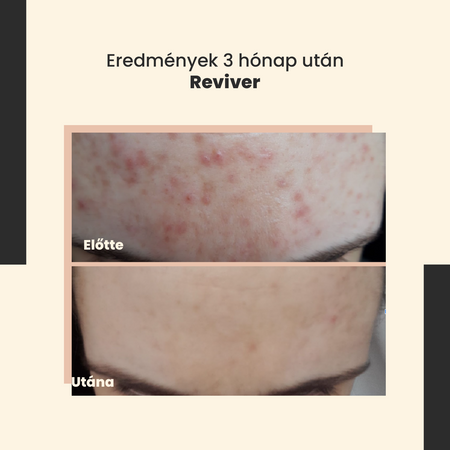 SkinTra - Reviver - Revitalizáló Szérum - 30ml