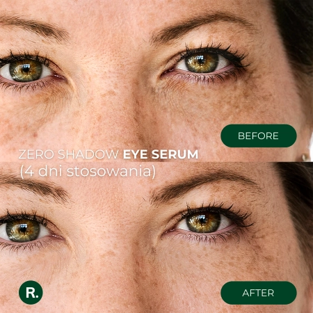 Ralls - Zero Shadow Eye Serum - Szemkörnyékápoló Szérum - 20ml