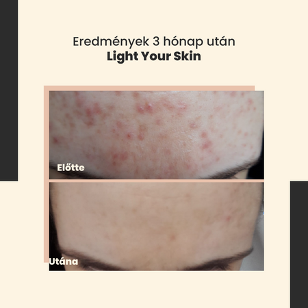 SkinTra - Light Your Skin - Szérum 20% C-vitaminnal és Ferulinsavval - 30ml