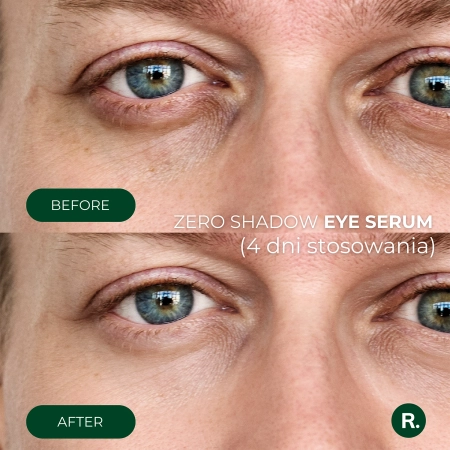 Ralls - Zero Shadow Eye Serum - Szemkörnyékápoló Szérum - 20ml