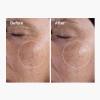 The Ordinary - Glycolic Acid 7% Exfoliating Toner - Hámlasztó Tonik 7% Glikolsavval - 240ml