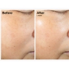 The Ordinary - Rice Lipids + Ectoin Microemulsion - Mikroemulzió Rizslipidekkel és Ektoinnal - 60ml