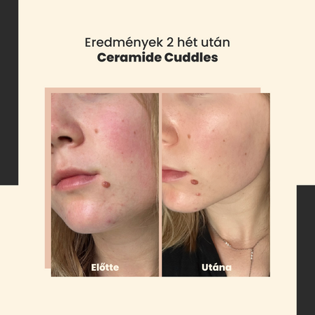 SkinTra - Ceramide Cuddles - Regeneráló Szérum - 30ml 