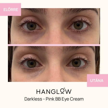 HanGlow - Darkless - Pink BB Eye Cream - Bőrápoló Szemkrém-Korrektor - 15ml